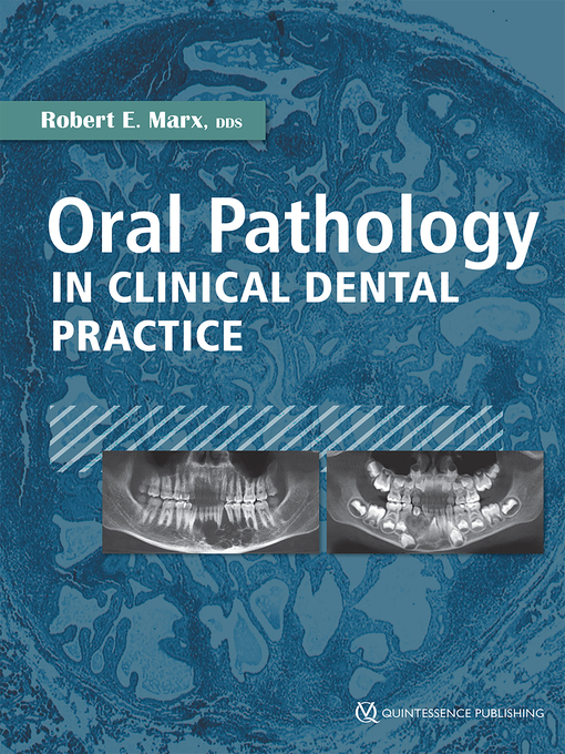 Title details for Oral Pathology in Clinical Dental Practice by Robert E. Marx - Wait list